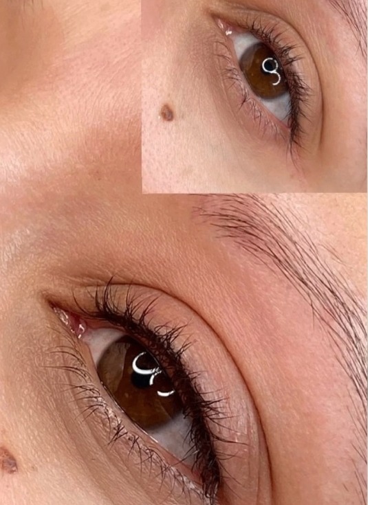 Lash Enhancement